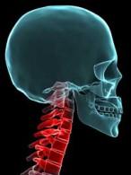 Head and neck x-ray image